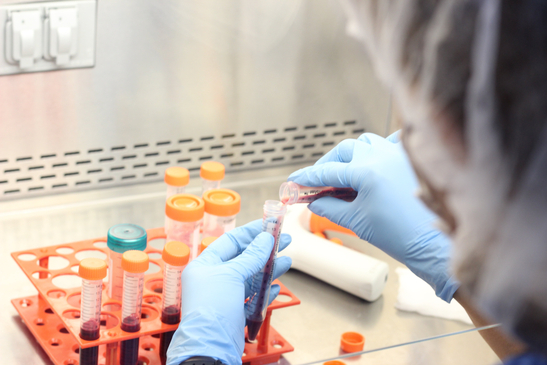 Slider image (6) ProVida Stem Cell Clinic